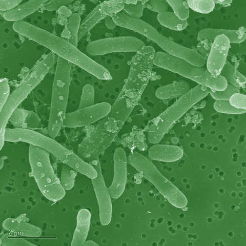 E. Coli